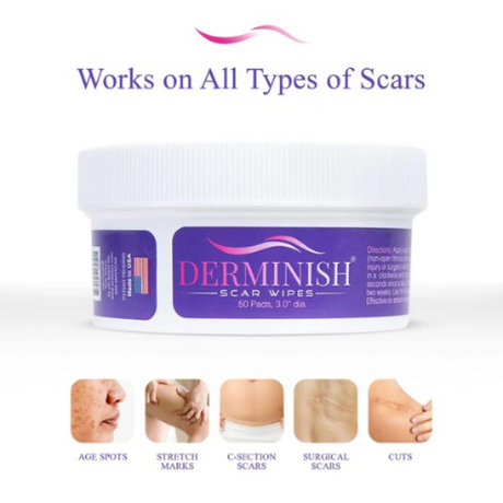 Derminish® Healing Scar Wipes