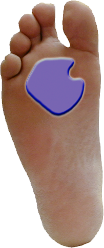 Dr. Jill's Gel Dancer's Pads