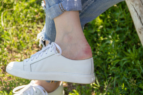 Can Using Antiperspirant on Your Feet Prevent Blisters and Improve Foot Health?